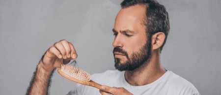 درمان  ریزش موی مردان
