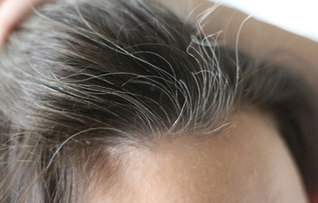 علت سفید شدن زود هنگام مو, چکار کنیم موهامون سفید بشه