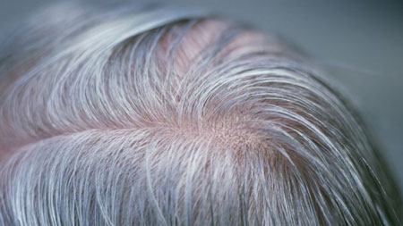 جلوگیری از سفیدی مو, جلوگیری از سفید شدن مو, برای جلوگیری از سفید شدن مو