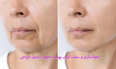 جوانسازی و سفت کردن پوست صورت بدون جراحی