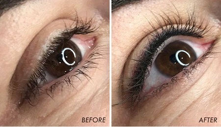 ورم و خارش بعد از تاتو خط چشم, درمان سریع التهاب چشم بعد از تاتو خط چشم, التهاب بعد از تاتو خط چشم