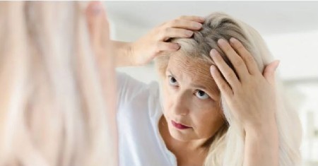 انواع ریزش مو در سالمندان