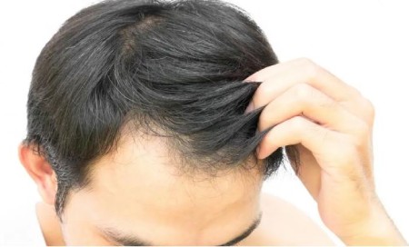 شیوه غیر دارویی درمان ریزش مو