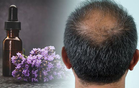 روغن اسطوخودوس, طریقه مصرف روغن اسطوخودوس برای مو, خاصیت روغن اسطوخودوس برای مو