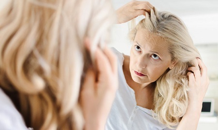  مراقبت از مو بعد از یائسگی, پیشگیری از ریزش مو یائسگی, ریزش مو یائسگی