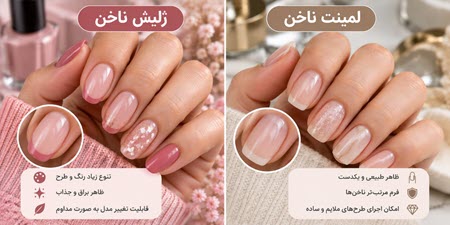 تفاوت لمینت و ژلیش از نظر ظاهر تفاوت لمینت و ژلیش از نظر ظاهر