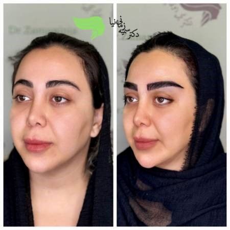 مدل های پرطرفدار کاشت ابرو