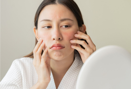 چگونه از پوست خود در برابر تغییرات هورمونی محافظت کنیم؟