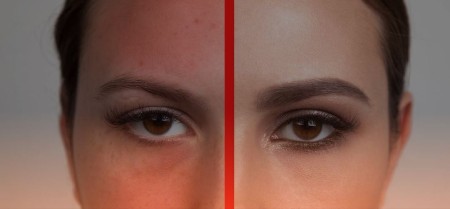 درمان خشکی و قرمزی پوست صورت
