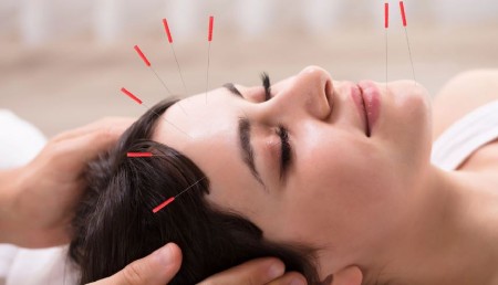 طب سوزنی برای جوانسازی پوست