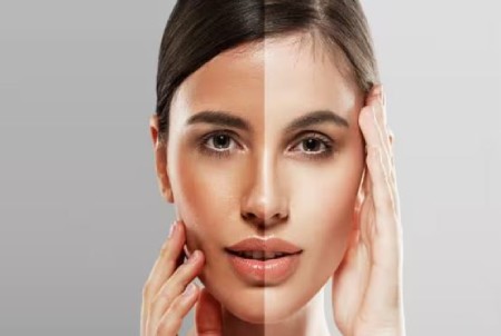 راه‌های طبیعی برای سفید کردن پوست