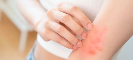 آلرژی و حساسیت دارویی چیست