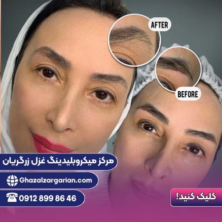 ریمو ابرو