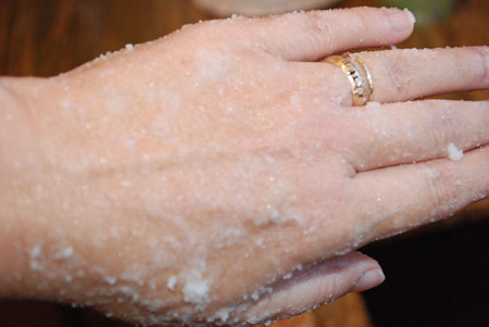 خشکی پوست دست,رفع خشکی پوست دست,چگونه می توان خشکی دست را درمان کرد