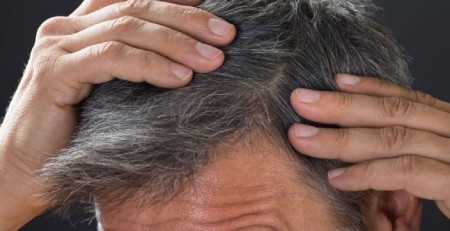 چه چیزی باعث سفید شدن مو می شود