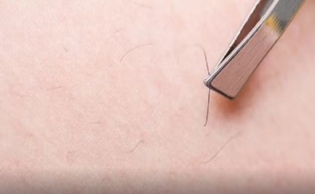 چرا کره ای ها موی زائد ندارند