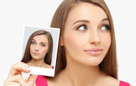از بین بردن جوش های صورت