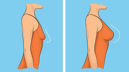 از چه سنی باید سوتین بست, سن مناسب بستن سوتین, رشد سینه در دختران