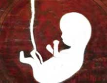 سقط جنین,علائم سقط جنین
