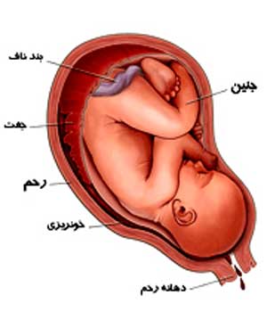 لکه‌بینی در بارداری,علت لکه‌بینی در بارداری