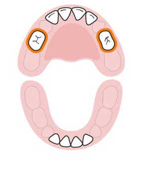 ترتیب رشد دندان های کودک,دندان های کودک,رشد دندان های کودک