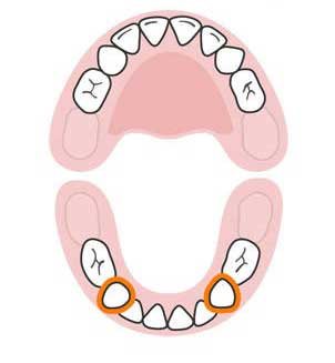 ترتیب رشد دندان های کودک,دندان های کودک,رشد دندان های کودک