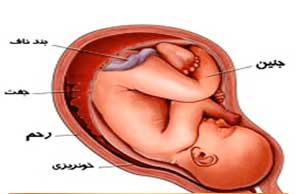 لکه‌بینی در بادرای,لکه‌بینی دوران بارداری