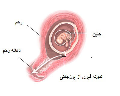 تست غربالگری در بارداری،انواع غربالگری های دوران بارداری