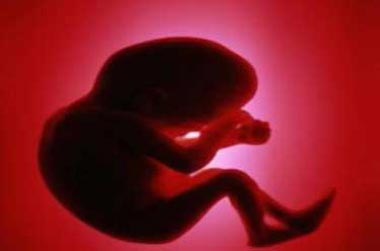درمان سقط جنین،جلوگیری از سقط جنین
