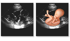 یک بارداری چند سونوگرافی می خواهد؟