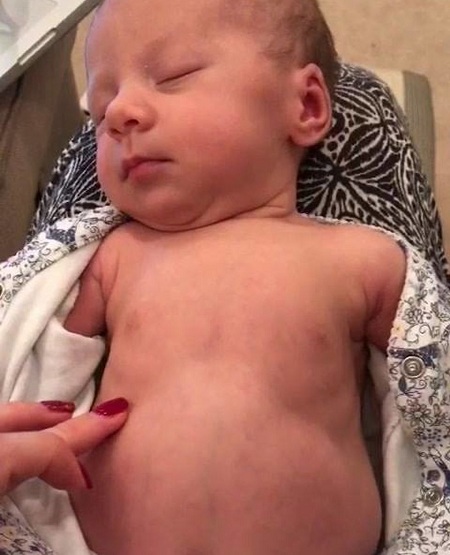 بررسی تنفس کودک هنگام خواب, تنفس در نوزادان, تنفس غیر طبیعی نوزاد