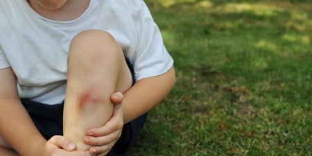کبودی در پوست کودکان, بیماری های مرتبط با کبودی پوست در کودکان, کبود شدن پا در کودکان