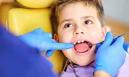 عوارض کشیدن دندان شیری کودکان, کشیدن دندان شیری آبسه کرده, کشیدن دندان شیری عفونی