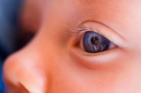 رنگ عنبیه نورادان