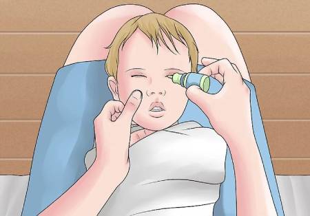چکاندن قطره در چشم نوزاد,نحوه‌ی ریختن قطره چشمی نوزادان