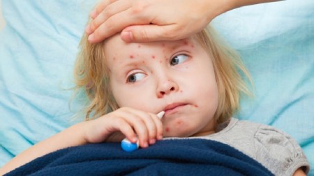 علل و انتقال بیماری های عفونی در کودکان
