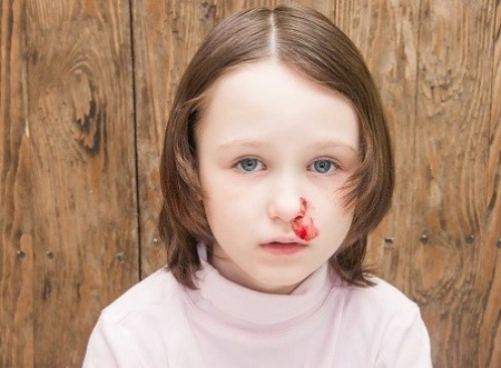 علل خونریزی بینی در کودکان چیست نکات مهم در زمان خونریزی بینی کودکان