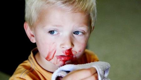 چه زمانی خونریزی بینی خطرناک است آیا خون دماغ شدن کودکان خطرناک است