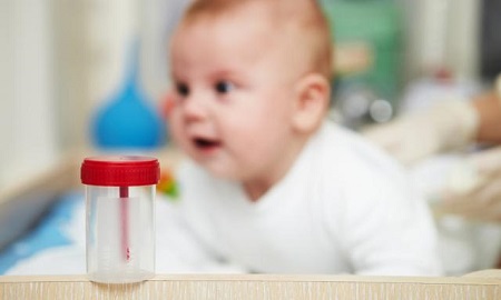 آزمایش ادرار در نوزادان, آزمایش ادرار نوزاد, انجام آزمایش ادرار برای نوزادان