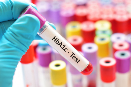 آزمایش a1c, رنج نرمال آزمایش a1c