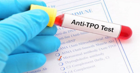 آزمایش anti tpo, شرایط آزمایش anti tpo