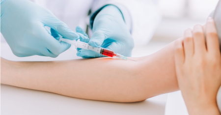 آزمایش anti ccp, مقدار نرمال anti ccp