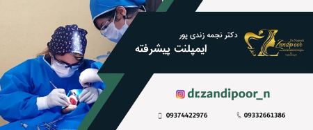 بهترین متخصص ایمپلنت دندان دکتر نجمه زندی پور,بهترین متخصص ایمپلنت دندان