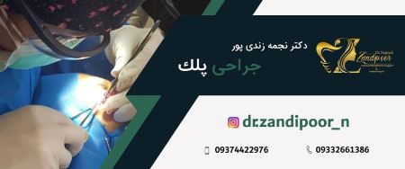 جراحی پلک دکتر نجمه زندی پور,جراحی پلک