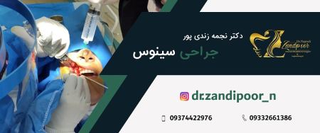جراحی سینوس ها دکتر نجمه زندی پور,جراحی سینوس ها