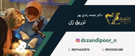 ساکشن و تزریق چربی دکتر نجمه زندی پور,ساکشن و تزریق چربی