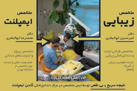 موفقیت ایمپلنت در بهترین مراکز شمال تهران