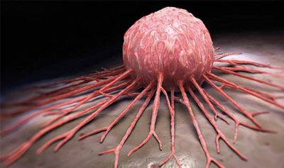 شكل تومور سرطان مثانه, رشد سلولي سرطان مثانه