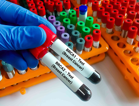 آزمایش brca, آزمایش ژنتیک brca