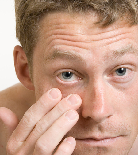 شایعترین علامت جداشدگی زجاجیه خلفی ظهور ناگهانی مگسپران است جداشدگی زجاجیه خلفی, تشخیص جداشدگی زجاجیه